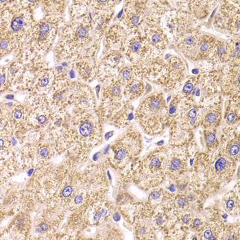 Immunohistochemistry of paraffin-embedded human liver damage using ST3GAL3 antibody  at dilution of 1:100 