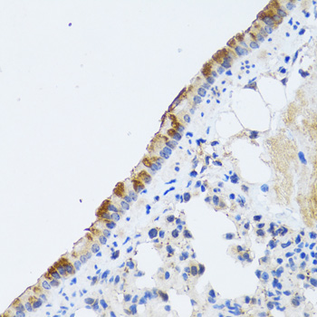 Immunohistochemistry of paraffin-embedded rat lung using ST3GAL3 antibody  at dilution of 1:100 