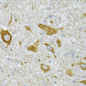 a08054 1 st3gal3 primary antiboties ihc testing 4