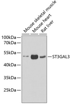 Western blot analysis of extracts of various cell lines, using ST3GAL3 antibody  at 1:1000 dilution
