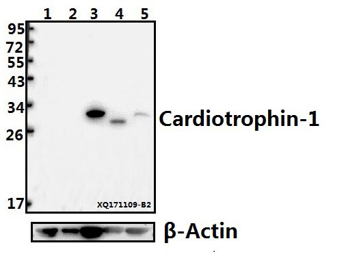 Western blot (WB) analysis of Cardiotrophin-1 (H31) pAb at 1:500 dilution
Lane1:PC3 whole cell lysate(40ug)
Lane2:K562 whole cell lysate(20ug)
Lane3:Jurkat whole cell lysate(40ug)
Lane4:The Muscle tissue lysate of Mouse(40ug)
Lane5:H9C2 whole cell lysate(40ug)