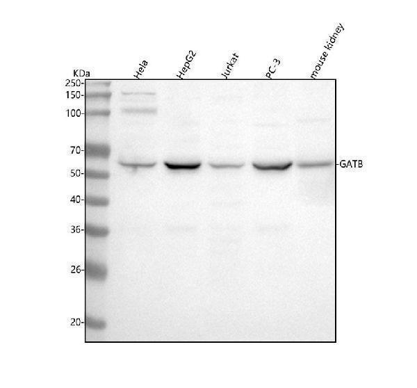  Western blot analysis of PET112/GATB using anti-PET112/GATB antibody (A08058-1)
