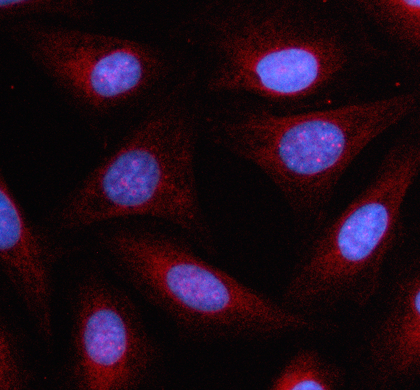 a08060 3 ldhc primary antibodies if testing 1