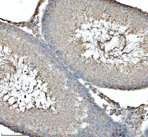 a08060 3 ldhc primary antibodies ihc testing 1