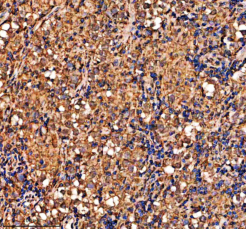 IHC analysis of LDHC using anti-LDHC antibody (A08060-3)