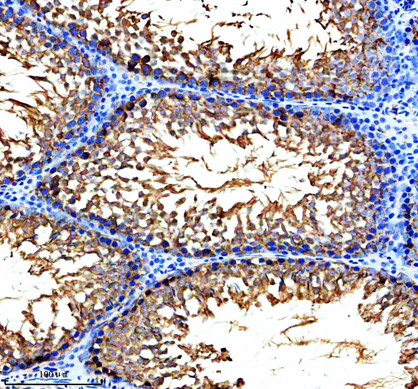 a08060 3 ldhc primary antibodies ihc testing 3