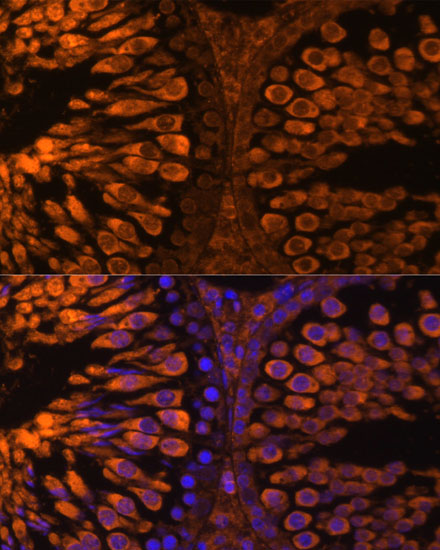 a08060 ldhc primary antiboties if testing 2