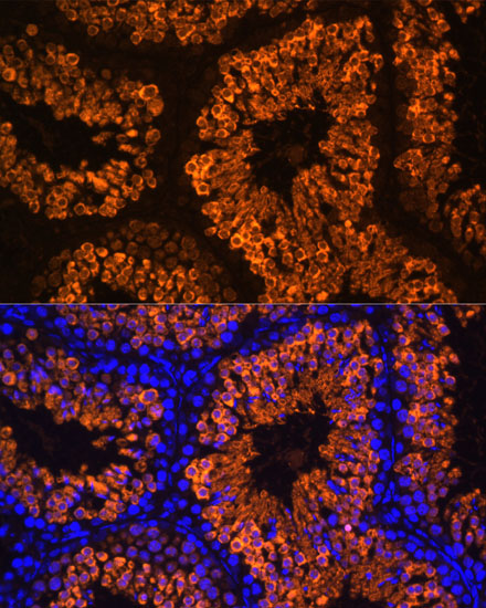 a08060 ldhc primary antiboties if testing 3