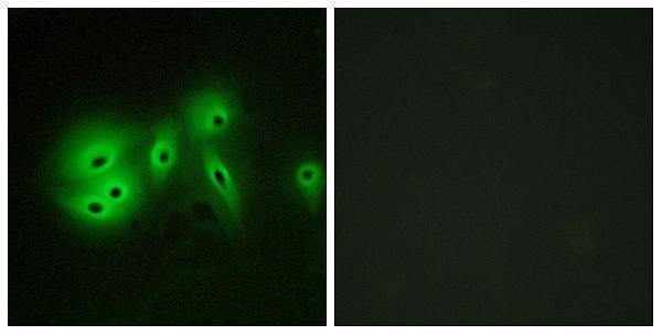 Immunofluorescence analysis of A549 cells, using ADCY8 Antibody
