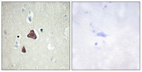 Immunohistochemistry analysis of paraffin-embedded human brain tissue, using ADCY8 Antibody