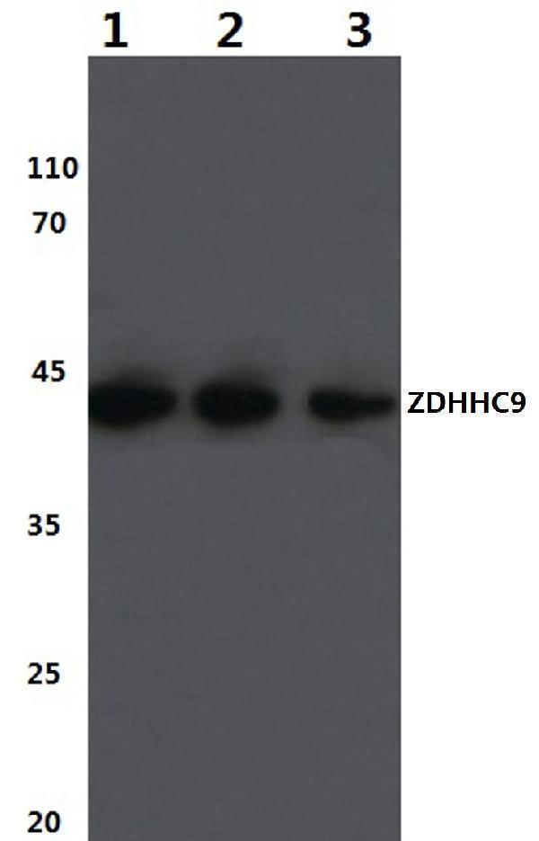 a08064 zdhhc9 primary antiboties wb testing 1