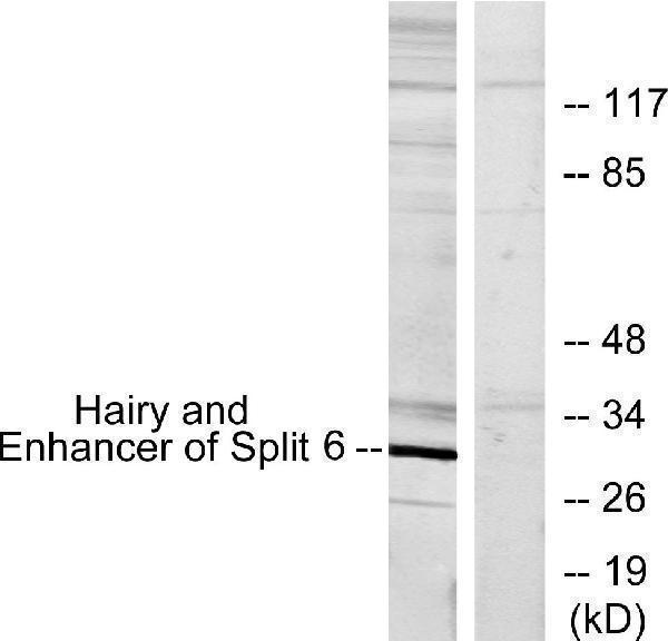 Western blot analysis of lysates from HeLa cells, using HES6 Antibody