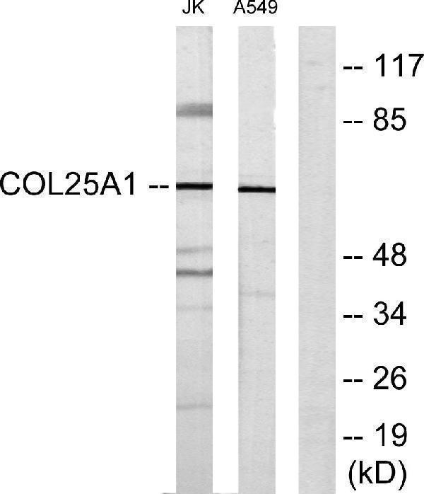 Western blot analysis of lysates from Jurkat and A549 cells, using Collagen XXV alpha1 Antibody