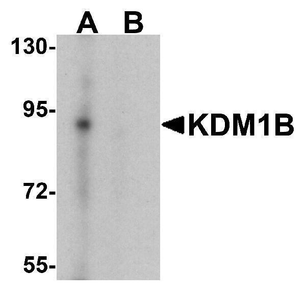 a08071 kdm1b primary antibodies wb testing 1