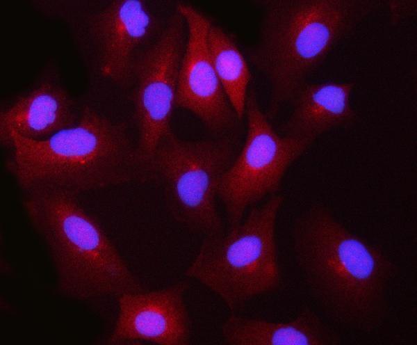  IF analysis of BLVRB using anti-BLVRB antibody (A08072-2)