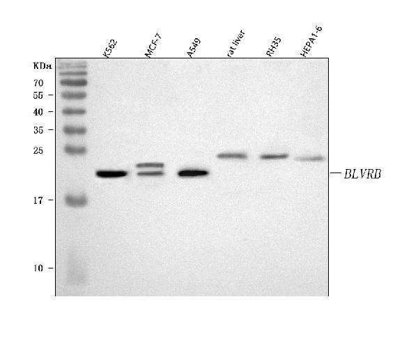 Western blot analysis of BLVRB using anti-BLVRB antibody (A08072-2)
