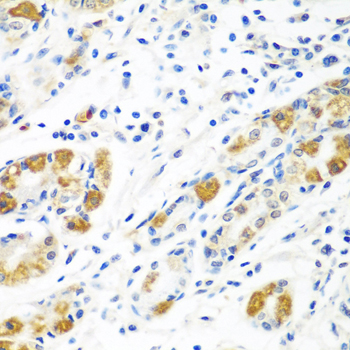 Immunohistochemistry of paraffin-embedded human stomach using BLVRB antibody  at dilution of 1:100 