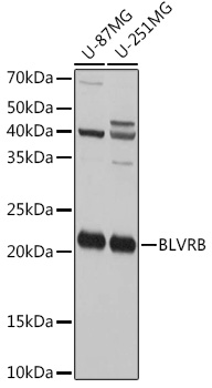 Western blot analysis of extracts of various cell lines, using BLVRB Rabbit pAb  at 1:1000 dilution