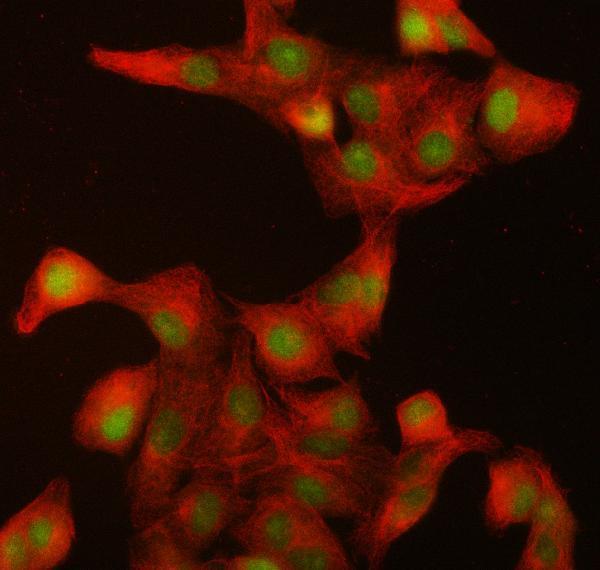  IF analysis of ILKAP using anti-ILKAP antibody (A08074-1) and anti-Beta Tubulin antibody (M01857-3)