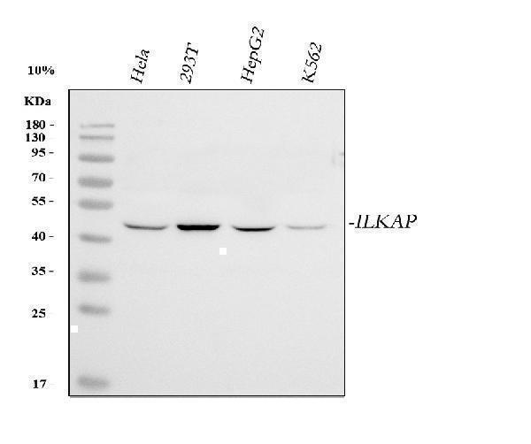  Western blot analysis of ILKAP using anti-ILKAP antibody (A08074-1)