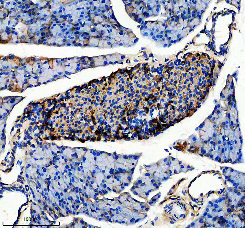 IHC analysis of FCHO2 using anti-FCHO2 antibody (A08075-1)