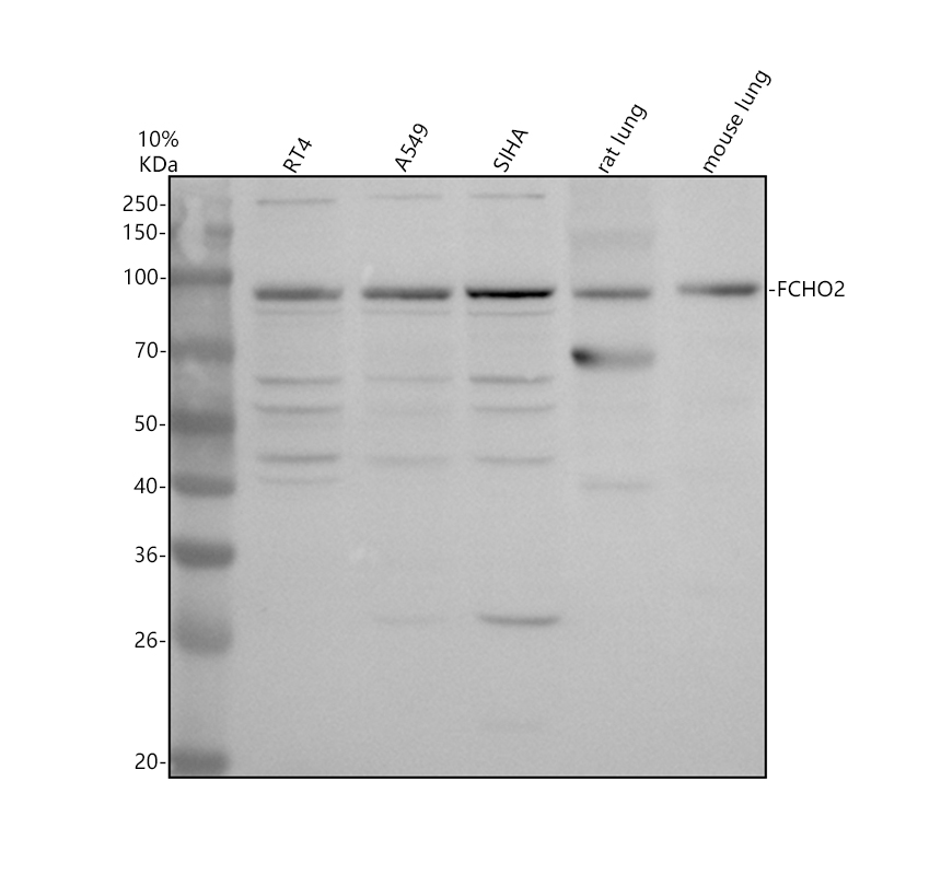 Western blot analysis of FCHO2 using anti-FCHO2 antibody (A08075-1)