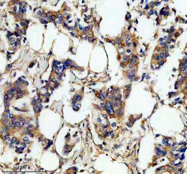 IHC analysis of SLC25A3 using anti-SLC25A3 antibody (A08076-1)