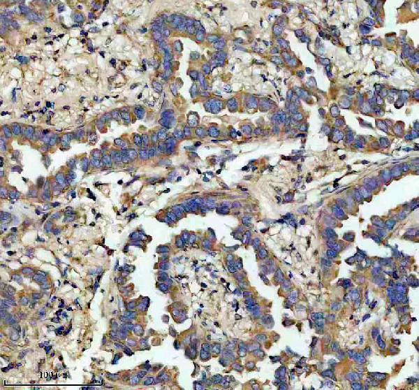 IHC analysis of SLC25A3 using anti-SLC25A3 antibody (A08076-1)