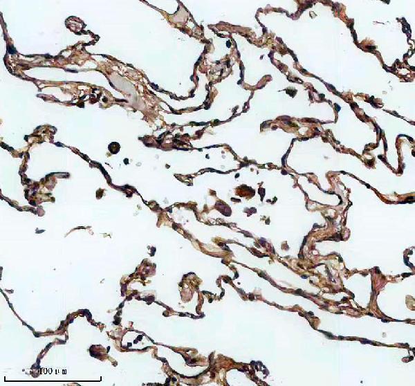 a08076 1 slc25a3 primary antibodies ihc testing 3