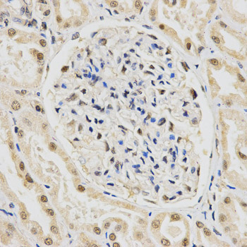 Immunohistochemistry of paraffin-embedded rat ovary using SNRPE Rabbit pAb  at dilution of 1:50 