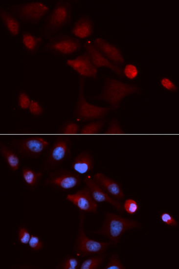 Immunohistochemistry of paraffin-embedded human thyroid cancer using SNRPE Rabbit pAb  at dilution of 1:50 
