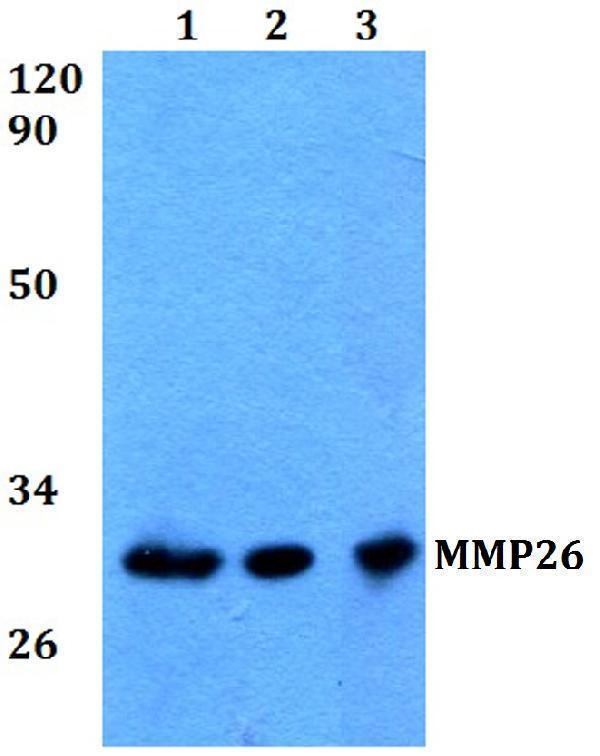 a08079 mmp26 primary antiboties wb testing 1