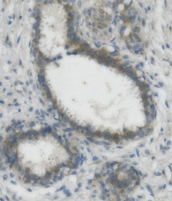a08081 2 nectin2 primary antibodies ihc testing 2