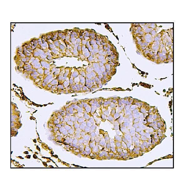 a08081 2 nectin2 primary antibodies ihc testing 4