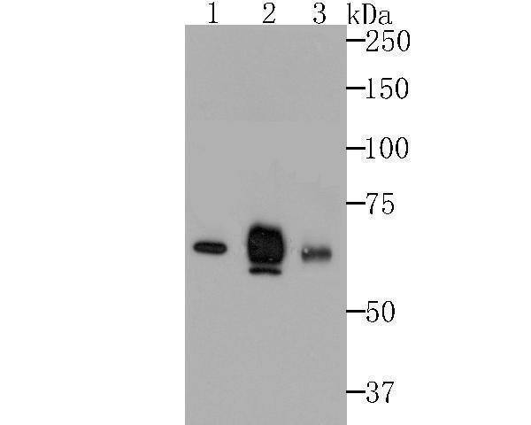 Western blot analysis of Nectin 2 on K562 (1), MCF-7 (2) and SK-OV-3 (3) cells lysates using anti-Nectin 2 antibody at 1/500 dilution