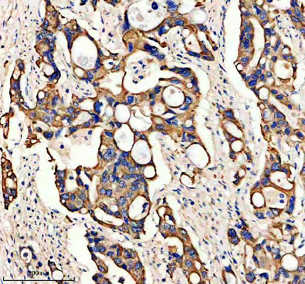 a08086 1 gys2 primary antibodies ihc testing 1
