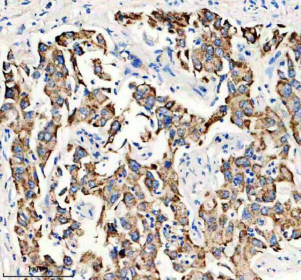 a08086 1 gys2 primary antibodies ihc testing 2