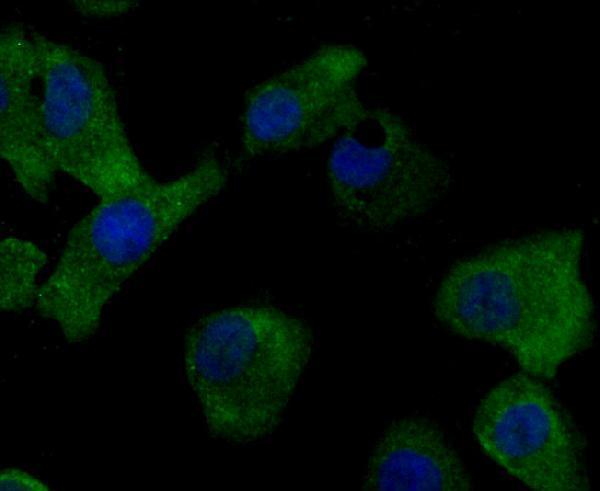 ICC staining MMP17 in A549 cells (green)