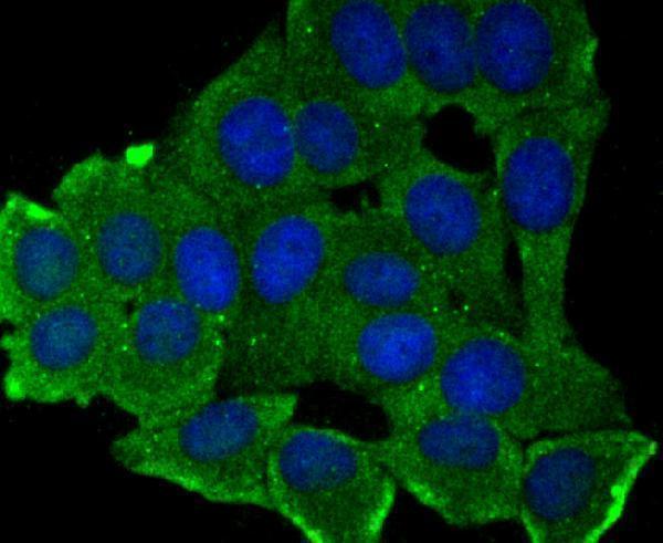 ICC staining MMP17 in MCF-7 cells (green)