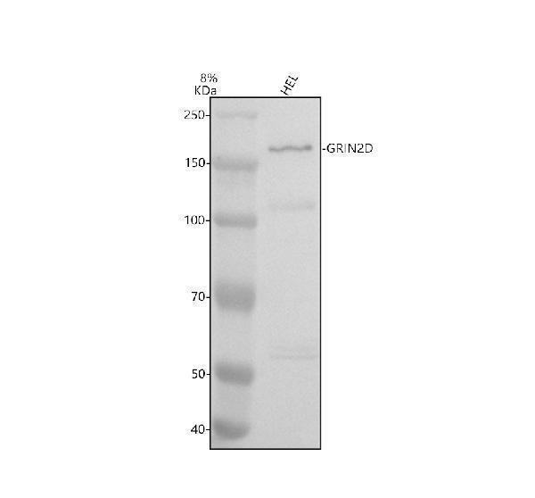 Western blot analysis of GRIN2D using anti-GRIN2D antibody (A08091-2)
