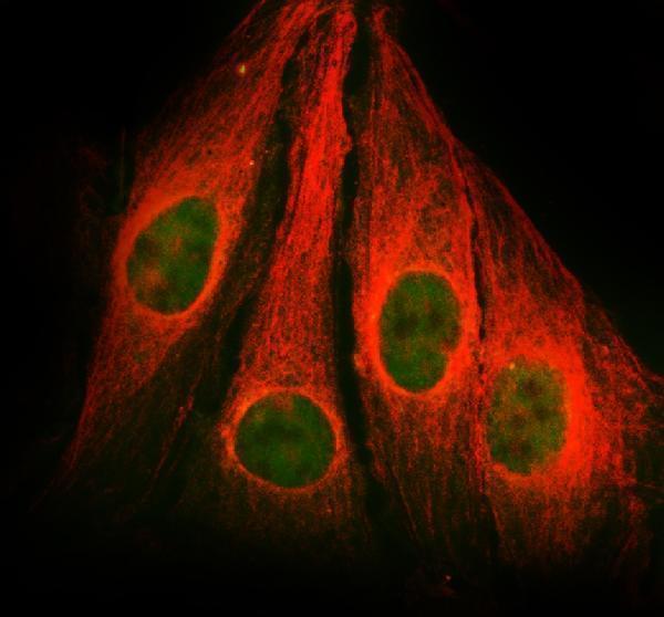 IF analysis of SLC4A3 using anti-SLC4A3 antibody (A08092-1) and anti-Alpha Tubulin antibody (M03989-3)