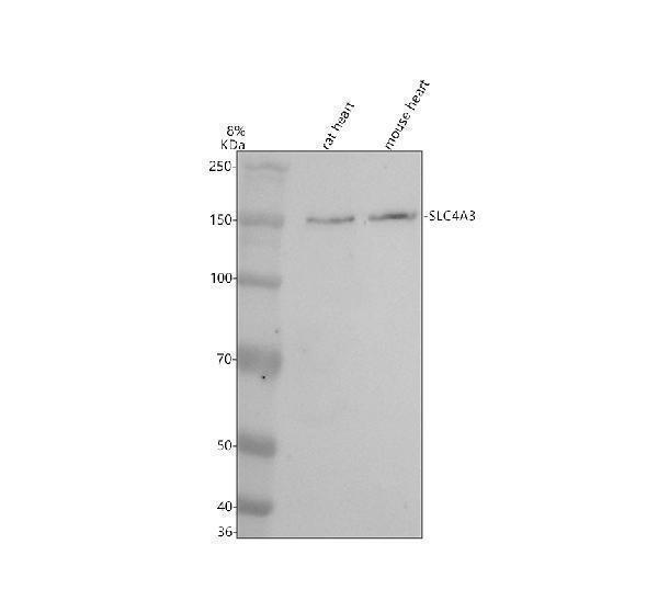 Western blot analysis of SLC4A3 using anti-SLC4A3 antibody (A08092-1)