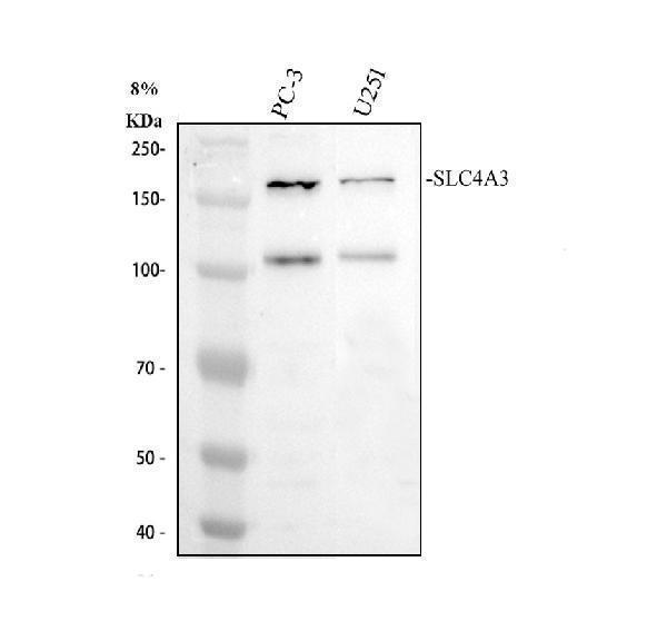 Western blot analysis of SLC4A3 using anti-SLC4A3 antibody (A08092-1)