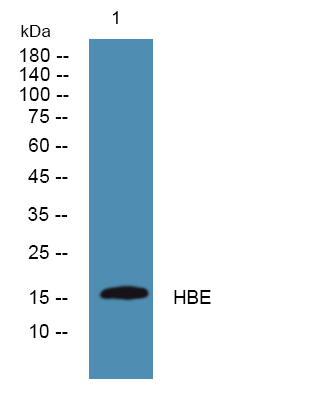 Western blot analysis of lysates from A431 cells, primary antibody was diluted at 1:1000, 4°over night