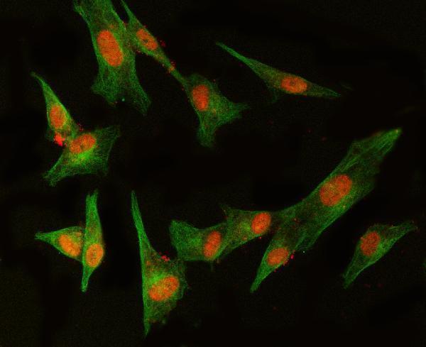 a08094 1 med8 primary antibodies if testing 4