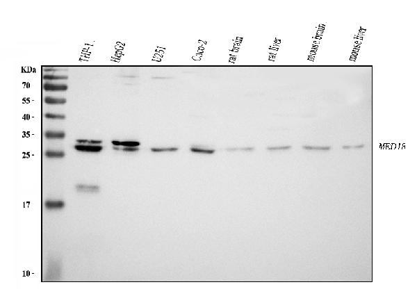 Western blot analysis of MED8 using anti-MED8 antibody (A08094-1).