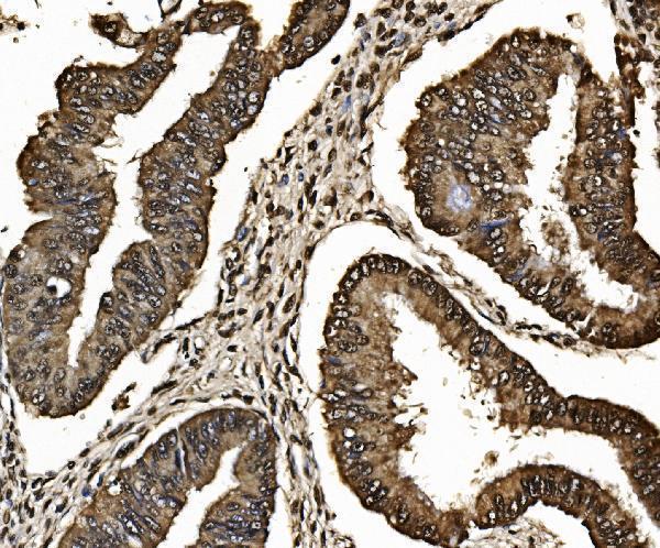 a08095 1 psmb7 primary antibodies ihc testing 10