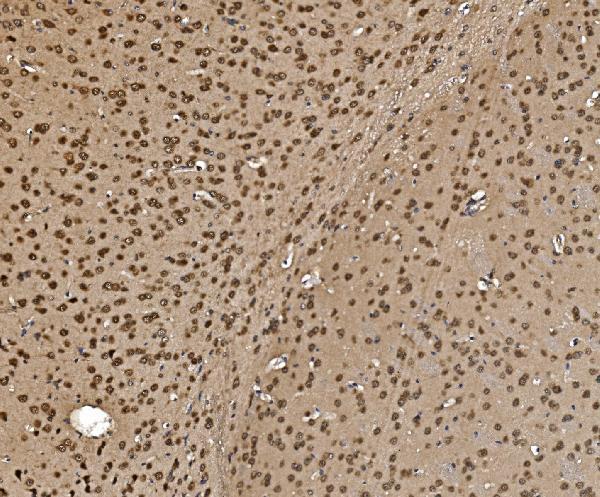  IHC analysis of Proteasome 20S Beta 7/PSMB7 using anti-Proteasome 20S Beta 7/PSMB7 antibody (A08095-1)