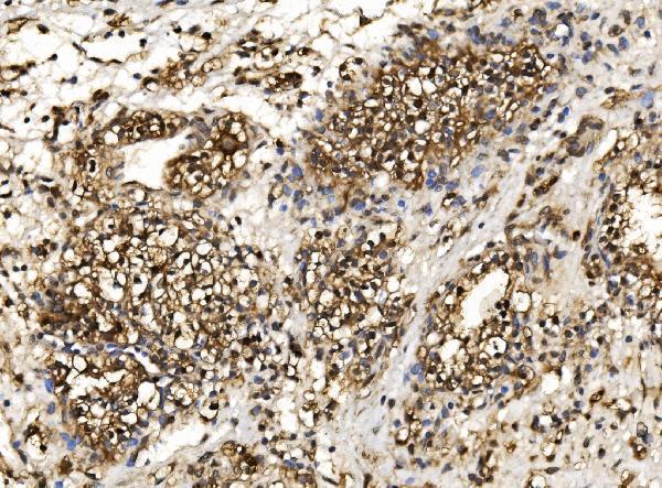 a08095 1 psmb7 primary antibodies ihc testing 5