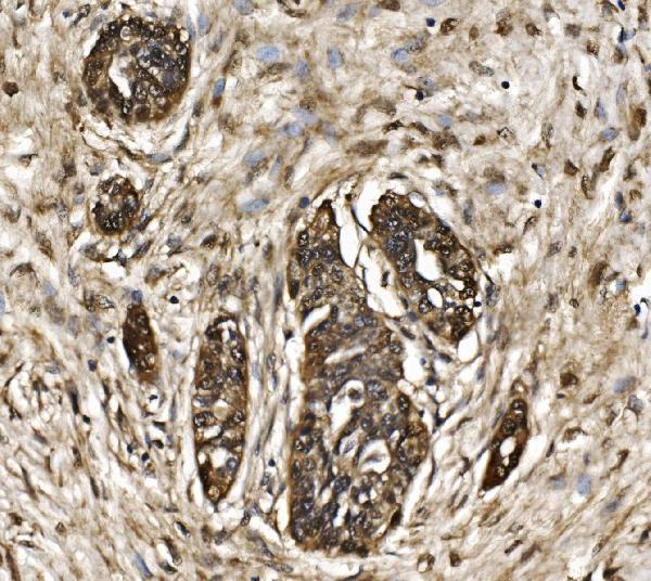 a08095 1 psmb7 primary antibodies ihc testing 6